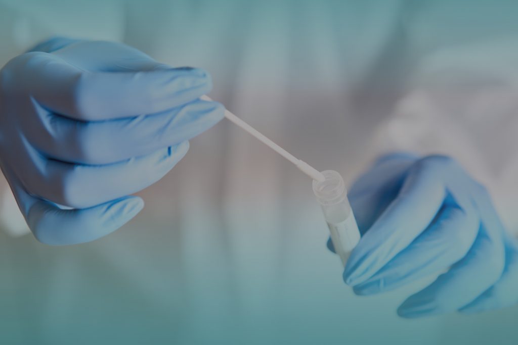 AED 65 अबू धाबी में सभी PCR परीक्षणों के लिए निर्धारित मूल्यः DOH